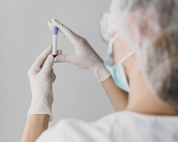 Should I Get My Hormone Levels Tested?